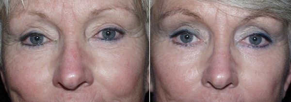 Software: Microsoft Office